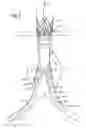 Fig. 09 - Stent graft delivery system with access conduit
