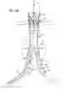 Fig. 12 - Stent graft delivery system with access conduit