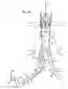 Fig. 15 - Stent graft delivery system with access conduit