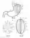 Fig. 03 - Elevating Stomach Stimulation Device