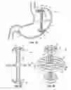Fig. 05 - Elevating Stomach Stimulation Device