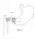 Fig. 15 - Satiation devices and methods