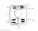 Fig. 01 - DYNAMIC HIP BRACE, HIP BRACE KIT AND METHOD OF USE