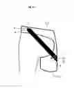 Fig. 10 - DYNAMIC HIP BRACE, HIP BRACE KIT AND METHOD OF USE