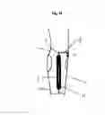 Fig. 13 - DYNAMIC HIP BRACE, HIP BRACE KIT AND METHOD OF USE