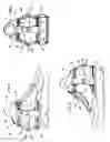 Fig. 03 - Multi-directional support system with flex support bars for use on footwear
