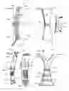 Fig. 07 - Multi-directional support system with flex support bars for use on footwear