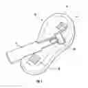 Fig. 02 - Quick clip for a club foot device