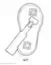 Fig. 03 - Quick clip for a club foot device