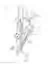 Fig. 12 - ORTHOTIC AND ASSISTIVE DEVICES, SYSTEMS AND METHODS