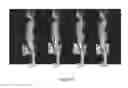 Fig. 30 - Posture improvement shapewear garment and systems