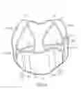 Fig. 09 - STERNUM SUPPORTING HARNESS