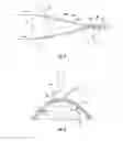 Fig. 03 - Systems and methods for chromatic aberration correction
