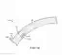 Fig. 11 - SCLERAL TRANSLOCATION ELASTO-MODULATION METHODS AND APPARATUS