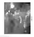 Fig. 17 - SCLERAL TRANSLOCATION ELASTO-MODULATION METHODS AND APPARATUS