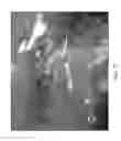Fig. 18 - SCLERAL TRANSLOCATION ELASTO-MODULATION METHODS AND APPARATUS