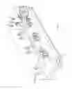 Fig. 02 - Method & Device for Containing Deadly Germs of a Patient During Treatment