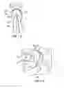 Fig. 16 - Rollator