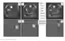 Fig. 01 - Targeted delivery of drugs to the myometrium via anti-oxytocin receptor antibodies
