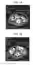 Fig. 02 - METHODS AND COMPOSITIONS FOR TREATING VIRAL OR VIRALLY-INDUCED CONDITIONS