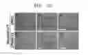Fig. 23 - Composition including ATM inhibitor for reducing cellular senescence and use of the composition