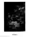Fig. 03 - Methods of reducing mammographic breast density and/or breast cancer risk