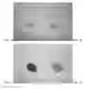 Fig. 02 - Methods of treating a gastrointestinal spasm associated with chemotherapy or radiation therapy