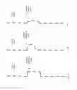 Fig. 12 - Spray dried human plasma