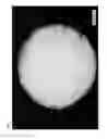 Fig. 03 - PERIODONTAL TISSUE REGENERATION MATERIAL