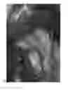 Fig. 04 - PERIODONTAL TISSUE REGENERATION MATERIAL