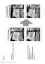 Fig. 06 - PERIODONTAL TISSUE REGENERATION MATERIAL