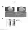 Fig. 41 - Compositions comprising selenium and use of same for the treatment and prevention of disease or conditions associated with mitochondrial dysfunction