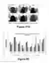 Fig. 18 - Molecular and herbal combinations for treating psoriasis
