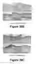 Fig. 20 - Molecular and herbal combinations for treating psoriasis