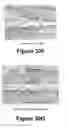 Fig. 22 - Molecular and herbal combinations for treating psoriasis