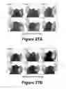 Fig. 15 - Molecular and herbal combinations for treating psoriasis