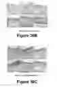 Fig. 20 - Molecular and herbal combinations for treating psoriasis