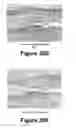 Fig. 21 - Molecular and herbal combinations for treating psoriasis