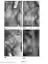 Fig. 06 - Pharmaceutical composition comprising a botulinum neurotoxin and uses thereof