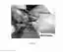 Fig. 03 - Compositions and Methods for Topical Application and Transdermal Delivery of Botulinum Toxins