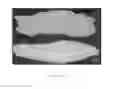Fig. 05 - Compositions and Methods for Topical Application and Transdermal Delivery of Botulinum Toxins