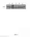 Fig. 29 - Recombinant HCMV and RHCMV vectors and uses thereof