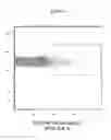 Fig. 28 - Nucleic acid molecule encoding hepatitis B virus core protein and surface antigen protein and vaccine comprising the same