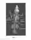 Fig. 04 - PSMA-binding agents and uses thereof