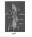 Fig. 05 - PSMA-binding agents and uses thereof