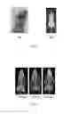 Fig. 02 - Kit for preparation of target radiopharmaceuticals and method of using it