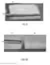 Fig. 06 - Composite grafts, systems, and methods
