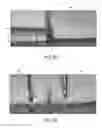 Fig. 07 - Composite grafts, systems, and methods