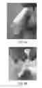 Fig. 09 - Composite grafts, systems, and methods