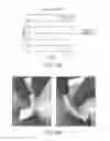 Fig. 13 - Composite grafts, systems, and methods